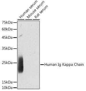 Human Ig Kappa Chain Rabbit mAb