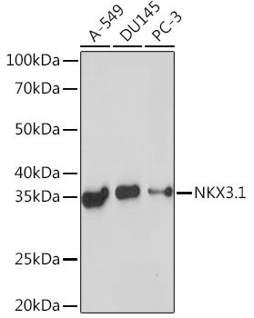 NKX3.1 Rabbit mAb