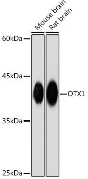 OTX1 Rabbit mAb
