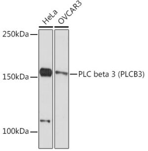 PLC beta 3 (PLCB3) Rabbit mAb