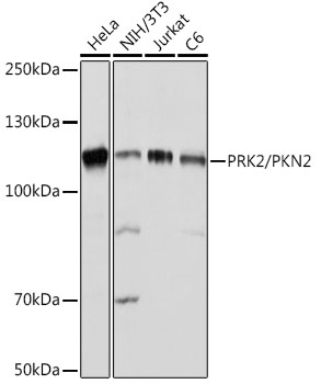 PRK2/PKN2 Rabbit mAb