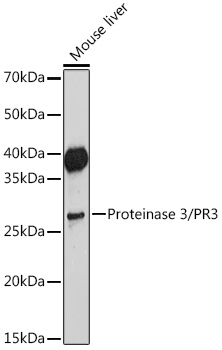Proteinase 3/PR3 Rabbit mAb
