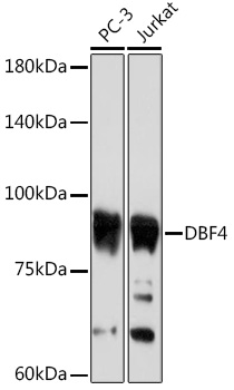 DBF4 Rabbit mAb