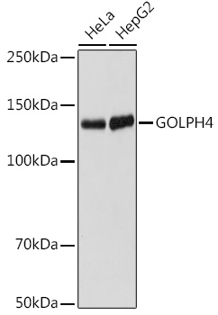 GOLPH4 Rabbit mAb