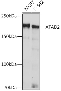 ATAD2 Rabbit mAb