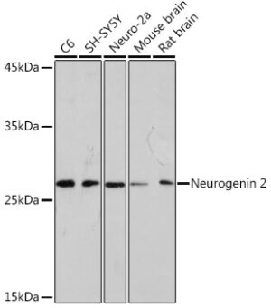 Neurogenin 2 Rabbit mAb