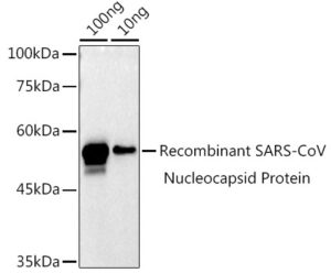 SARS-CoV-2 N Protein Rabbit pAb