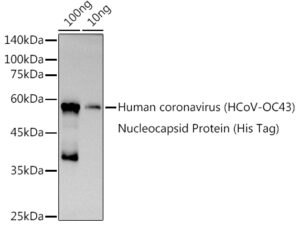 HCoV-OC43 Nucleoprotein Rabbit pAb