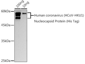 HCoV-HKU1 Nucleoprotein Rabbit pAb