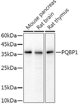 PQBP1 Rabbit mAb