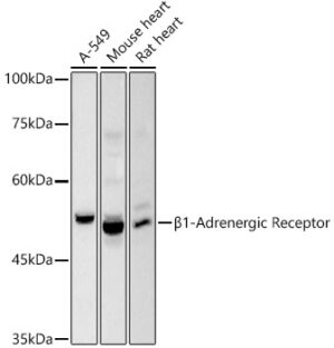 β1-Adrenergic Receptor Rabbit pAb