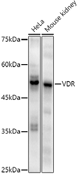 VDR Rabbit mAb