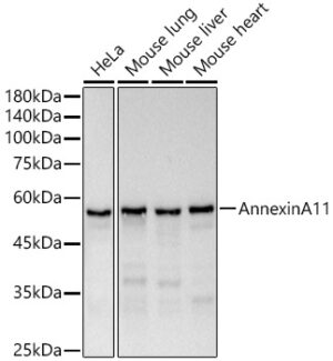 Annexin A11  Rabbit mAb