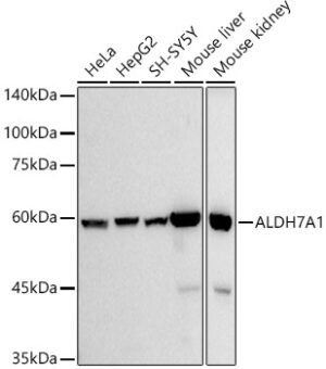 ALDH7A1 Rabbit mAb
