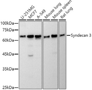 Syndecan 3 Rabbit mAb