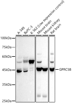 GPRC5B Rabbit mAb