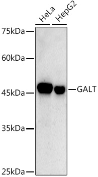 GALT Rabbit mAb