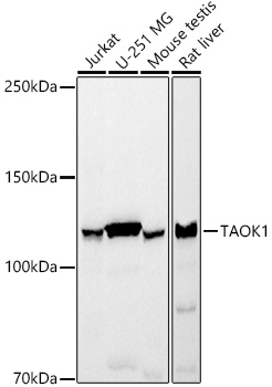 TAOK1 Rabbit mAb