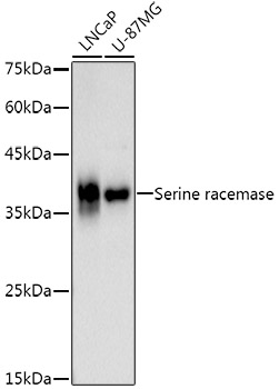 Serine racemase Rabbit mAb