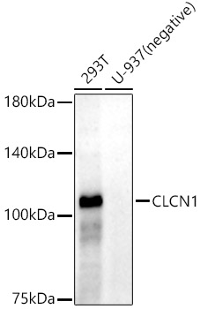 CLCN1 Rabbit mAb