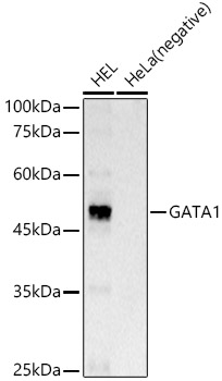 GATA1 Rabbit mAb