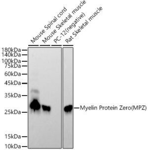 Myelin Protein Zero (MPZ) Rabbit mAb