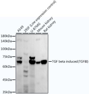 TGF beta induced (TGFBI) Rabbit mAb