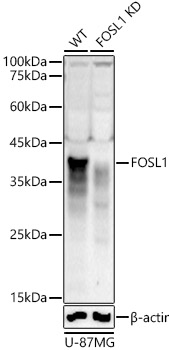 [KD Validated] FOSL1 Rabbit pAb