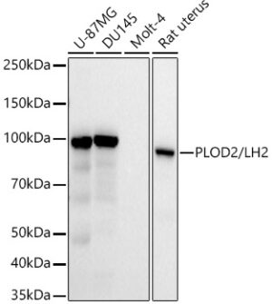 PLOD2/LH2 Rabbit mAb