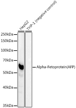 Alpha-Fetoprotein (AFP) Rabbit mAb
