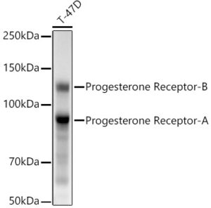 Progesterone Receptor Rabbit mAb