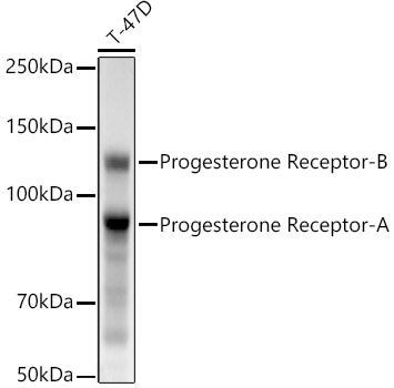 Progesterone Receptor Rabbit mAb