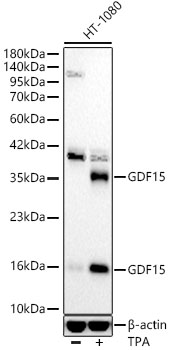 GDF15 Rabbit mAb