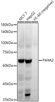 P4HA2 Rabbit mAb