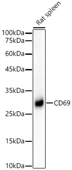 CD69 Rabbit mAb