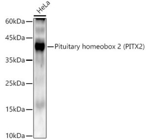 Pituitary homeobox 2 (PITX2) Rabbit mAb