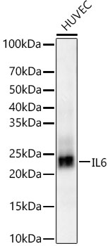 IL-6 Rabbit mAb