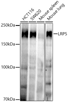 LRP5 Rabbit mAb