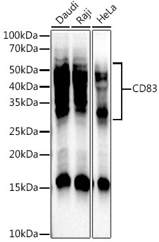 CD83 Rabbit mAb