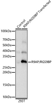 R9AP/RGS9BP Rabbit pAb