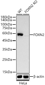 [KO Validated] FOXN2 Rabbit mAb