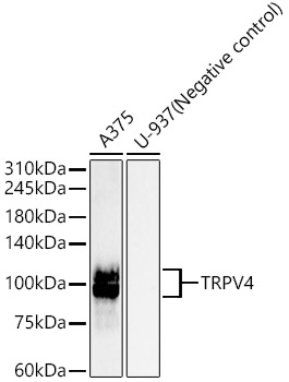 TRPV4 Rabbit mAb