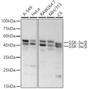 GSK-3α/β Rabbit mAb