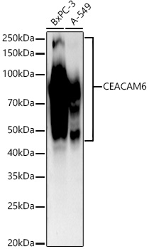 CEACAM6 Rabbit mAb