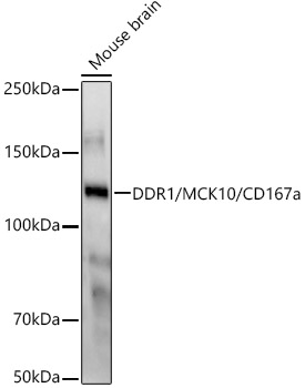 DDR1/MCK10/CD167a Rabbit mAb