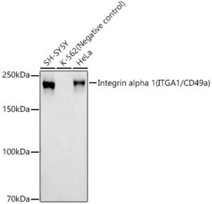Integrin alpha 1 (ITGA1/CD49a) Rabbit mAb