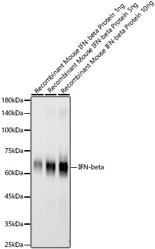 IFN-beta Rabbit mAb