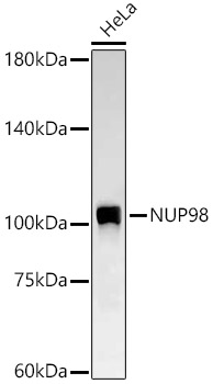 NUP98 Rabbit mAb