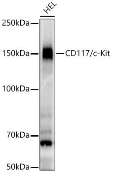 CD117/c-Kit Rabbit mAb