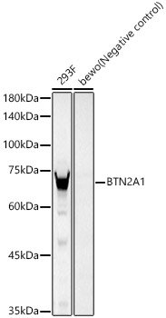 BTN2A1 Rabbit mAb
